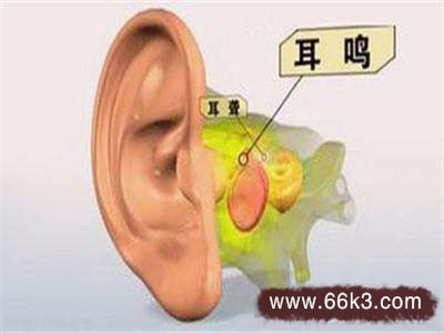 耳鸣如何冶 介绍8种治耳鸣的偏方