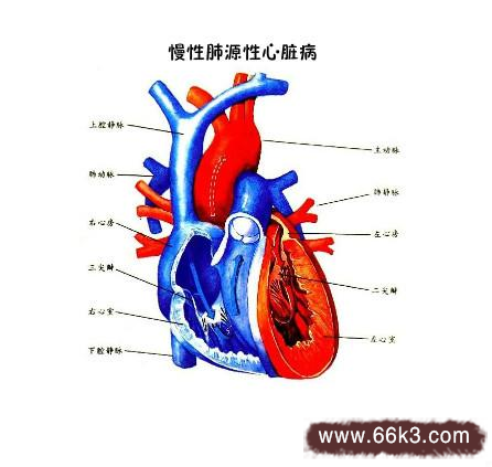中医治疗慢性肺源性心脏病特效秘方