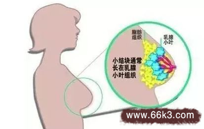 中医治疗乳腺增生名方